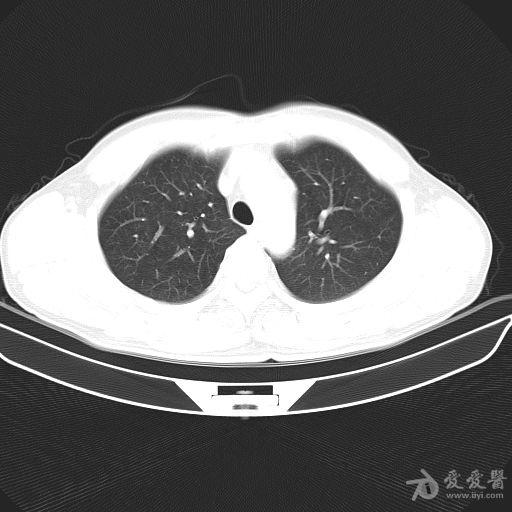 肺炎疫情下的温馨日常，小明的奇妙经历与深厚友情传递爱与陪伴的力量